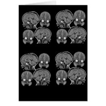 BRAINS! (MRI) GREETING CARDS