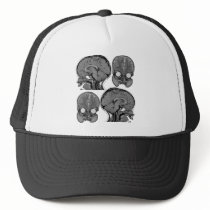 BRAINS! (MRI) TRUCKER HATS
