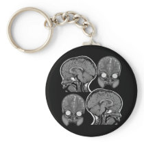 BRAINS! (MRI) KEY CHAINS