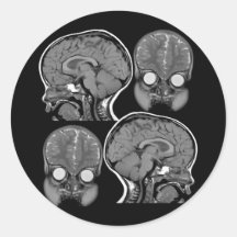 BRAINS! (MRI) ROUND STICKERS