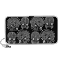 Brains! MRI Speaker