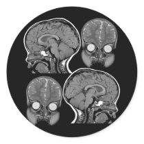 BRAINS! (MRI) ROUND STICKERS