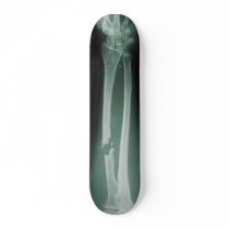 Broken Bones Custom Skateboard