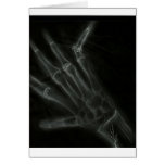 Broken Hand X-ray Greeting Cards