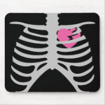 Broken Heart in Ribcage Mouse Mats