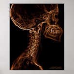 Brown/Gold C-spine X-ray poster