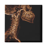 Brown/Gold C-spine X-ray square magnet