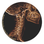 Brown/Gold C-spine X-ray sticker
