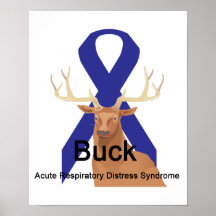 Buck Acute-Respiratory-Distress Syndrome Poster