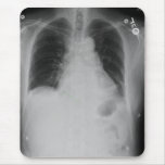 Cardiac Surgery ~ mousepad
