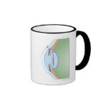 Cataract Surgery Coffee Mugs