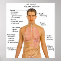 Chart of the Side Effects of Opioid Hydrocodone Posters