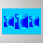 Chiropractic Poster: Lateral Cervical Blues posters