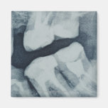 Close-up of a dental X-Ray Fridge Magnet