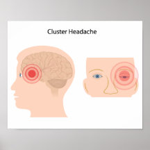Cluster headache Poster