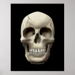 Cracked Skull posters