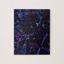 Dark neurons puzzle
