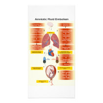 Diagram of an Amniotic Fluid Embolism AFE