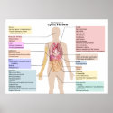 Diagram of the Manifestations of Cystic Fibrosis posters