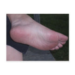 DOMINANT FOOT postcards