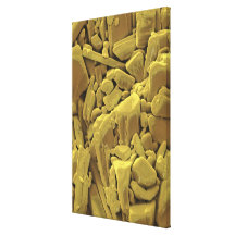 Doxycycline is a member of the tetracycline antibi gallery wrapped canvas