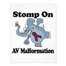 Elephant Stomp On AV Malformation Announcement