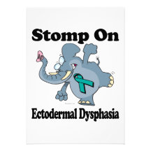 Elephant Stomp On Ectodermal Dysphasia Personalized Announcements