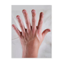 Extra Digit Post Cards