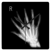 Extra Digit X-ray Right Hand