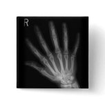 Extra Digit X-ray Right Hand buttons