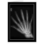 Extra Digit X-ray Right Hand cards
