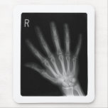 Extra Digit X-ray Right Hand Mouse Pads