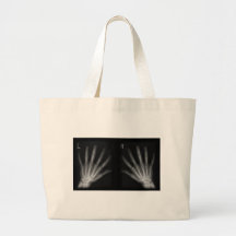 Extra Digit X-ray Right & Left Hands Canvas Bag