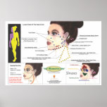 Facial Cupping Poster posters
