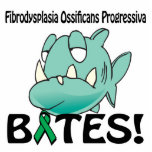 Fibrodysplasia Ossificans Progressiva BITES photo sculptures