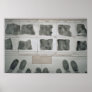 Fingerprints