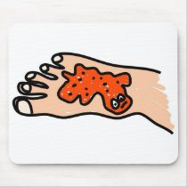Foot Disease mousepads