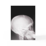 Foot in Mouth X-Ray Greeting Cards