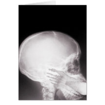 Foot in Mouth X-Ray Greeting Cards