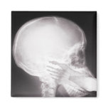 Foot in Mouth X-Ray magnets