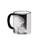 Foot in Mouth X-Ray mugs