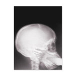 Foot in Mouth X-Ray Post Card
