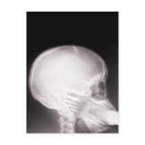 Foot in Mouth X-Ray Post Card