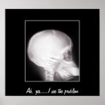 Foot in Mouth X-Ray posters