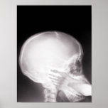 Foot in Mouth X-Ray posters