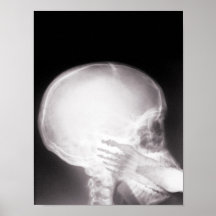 Foot in Mouth X-Ray Print