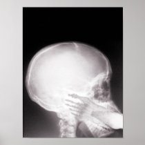 Foot in uth X-Ray Print