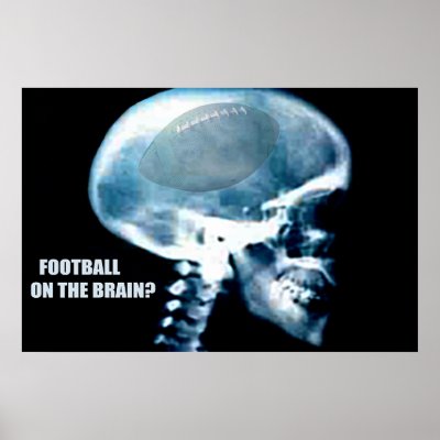 Football Head (x-ray) Posters by draemknot