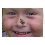 frog on nose cards