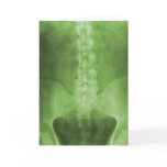 Green Digital X-Ray Art Greeting Card